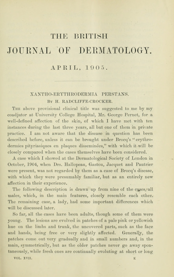 The British Journal of Dermatology, April 1905 The British Journal of Dermatology, April 1905