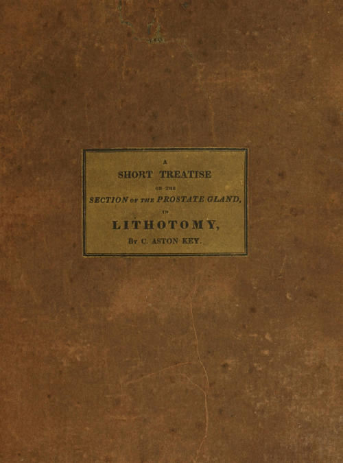 A Short Treatise on the Section of the Prostate Gland in Lithotomy
With an Explanation of a Safe and Easy Method of Conducting the Operation on the Principles of Cheselden